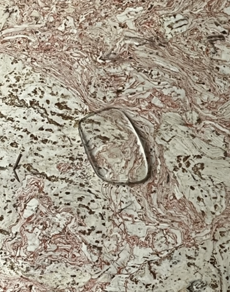 2025-11-21 - Eyeglass Lens